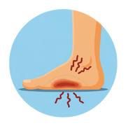 Flat Feet