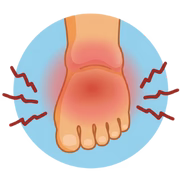 Foot Swelling