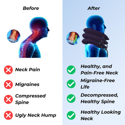 Dainely Neck Stretcher – Naturally Eliminate Neck Pain